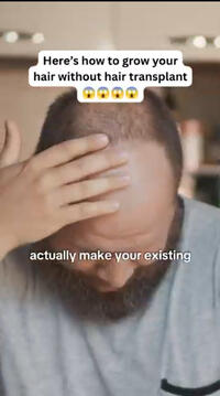 HAIR LOSS